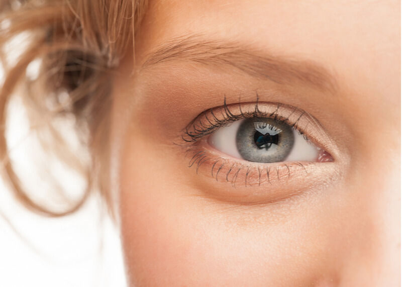 How To Reduce and Prevent Under Eye Lines and Bags