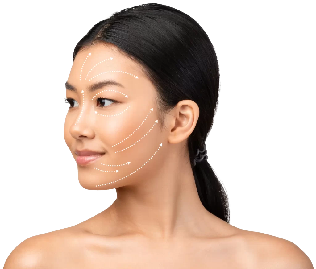 Superficial Musculoaponeurotic System (SMAS) Facelift - Illumia Medical