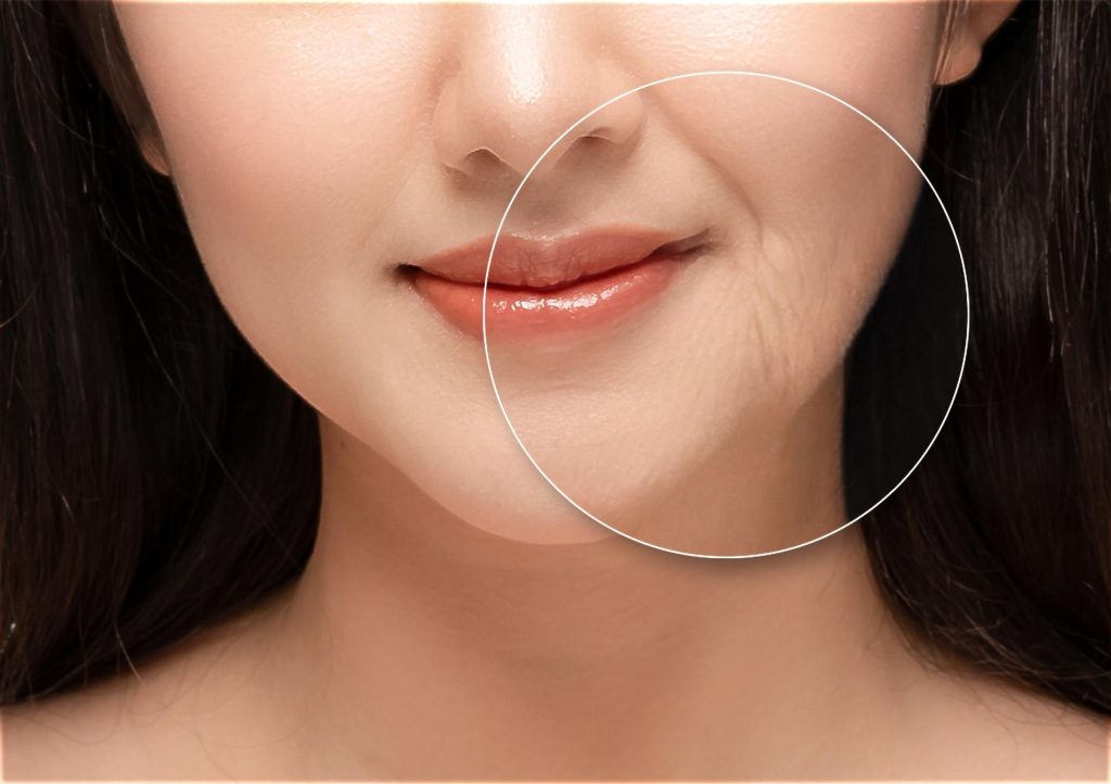 How Ageing Affects the Face - Illumia Medical